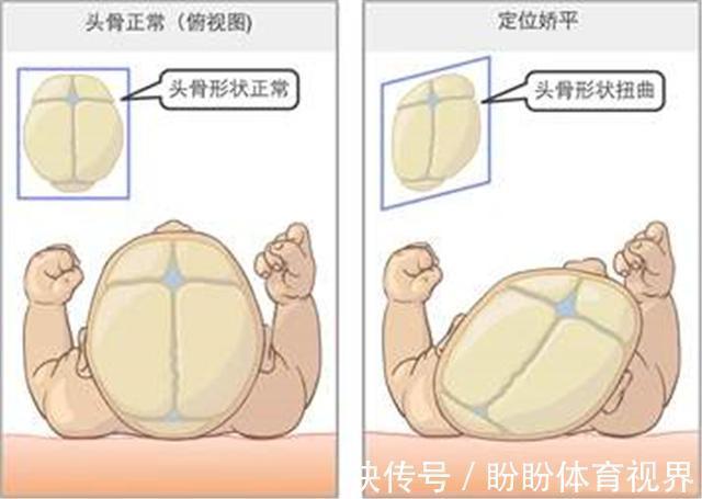 小洁|为什么以前的老人,执意要给孩子睡''扁头''?圆头更聪明?