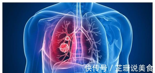 王教授|北大人民医院刘医生父亲查出了肺癌,希望放弃治疗,我没同意