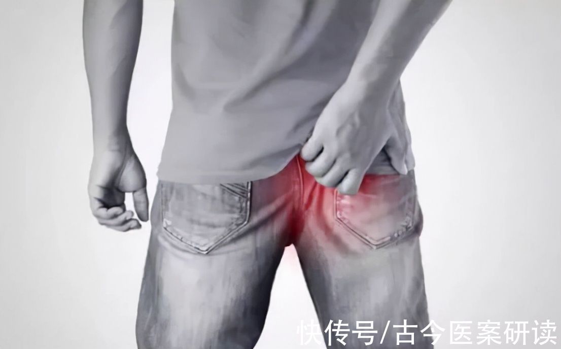 痔疮|“菊花”一疼,痔疮更严重,医生:养成好习惯才能自愈