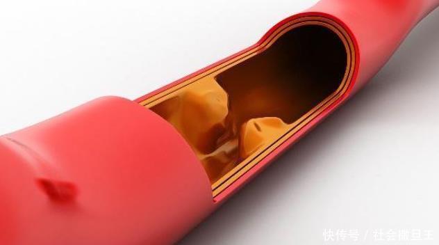 身体|寿命长的人,身体一个“部位”或许摸上去比较软,看看你符合吗