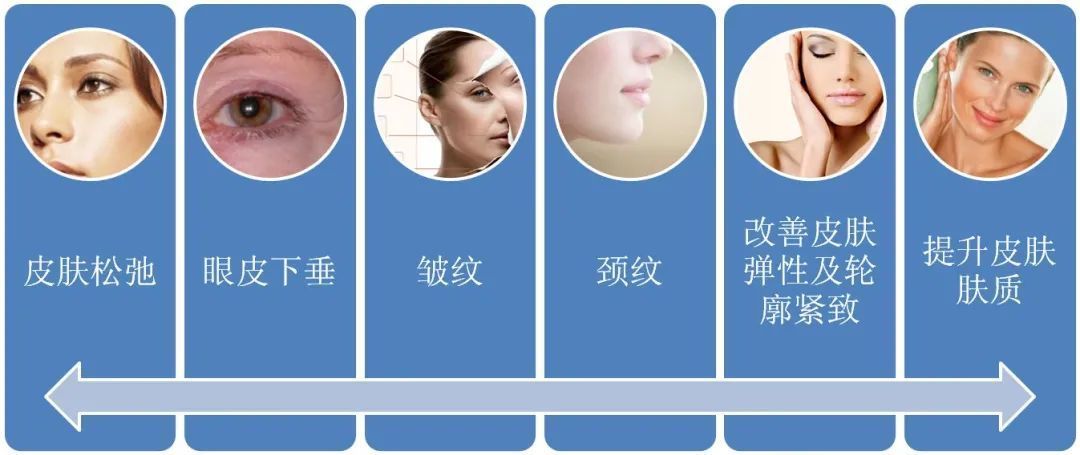 有效率|夏季适合做热玛吉吗?丨科普篇