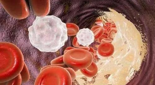 堵塞|中医直言血管一堵,易生百病,常吃5种蔬菜血管不再堵,别错过