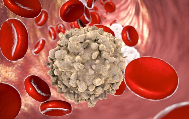 白血病 染发到底对身体有没有害一年最多染几次做好3件事可减少伤害