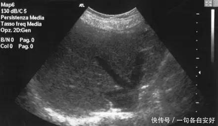 彩色|普通B超、彩超和三维、四维彩超有什么区别,孕妈带你图解!