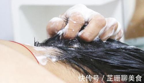 头发|头皮上抠出很多“白泥”，只是头皮屑，还是螨虫在头上扎窝了