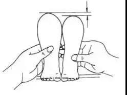 发育不良|宝宝髋关节发育不良戴吊带矫正会影响腿型吗