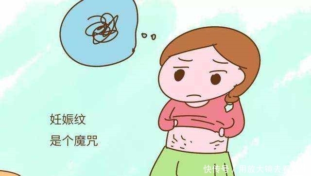 “妊娠纹就是女人的天敌”,产后妊娠纹,3种方法教你消除