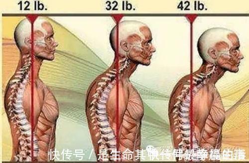 头晕|颈椎安康:得了颈椎病不要怕,四个防护方法助您保护您的颈椎