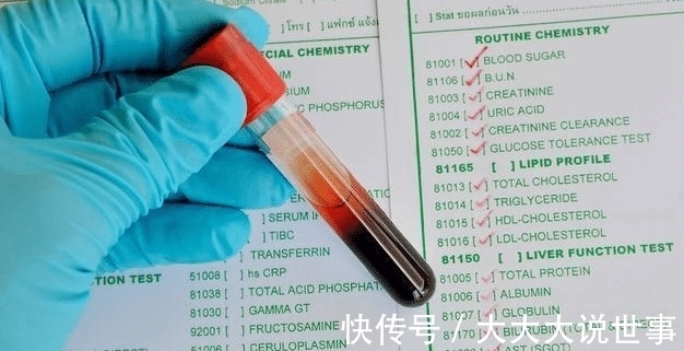 诊断|血常规能查出癌症吗?医生:“揪出”早期癌症,不要放过这3项