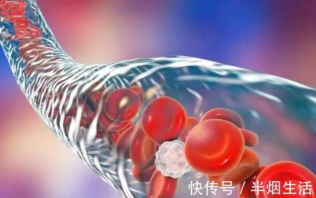 食物|血脂超标的人,鸡蛋可以吃,但这几类食物,请停止食用,切莫贪嘴