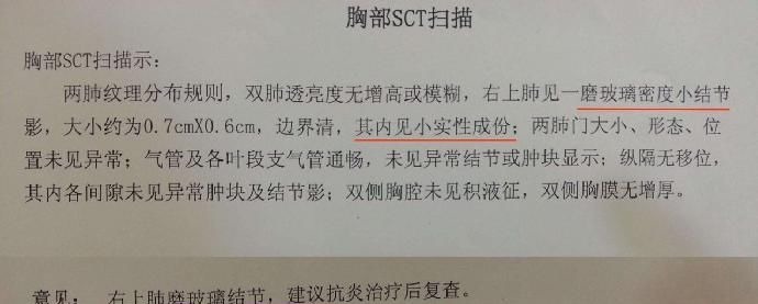 卵巢囊肿|结节、息肉、囊肿是癌症先兆吗?北肿专家们说出了真相!