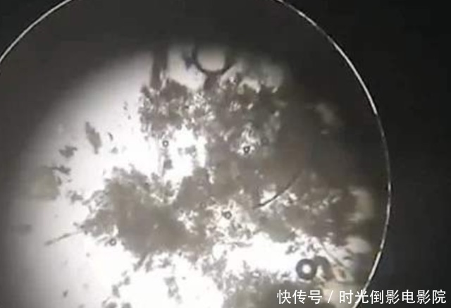 洗澡时搓出的黑泥是什么?显微镜不断放大后,终于看清楚了