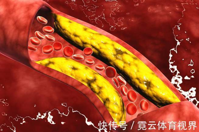 长寿秘诀|107岁老人,年轻像60岁,长寿秘诀不是多走路,而是3件事