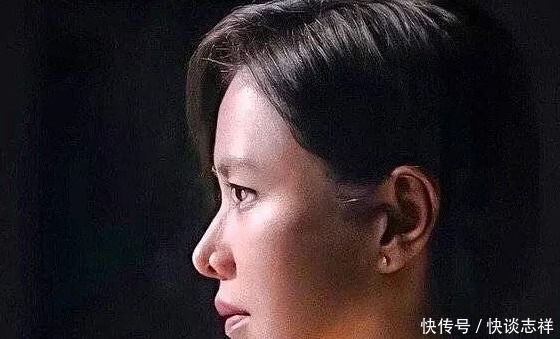 鼻尖抬高,鼻翼惊现疤痕,号称天然美女代名词的她,也翻车了?
