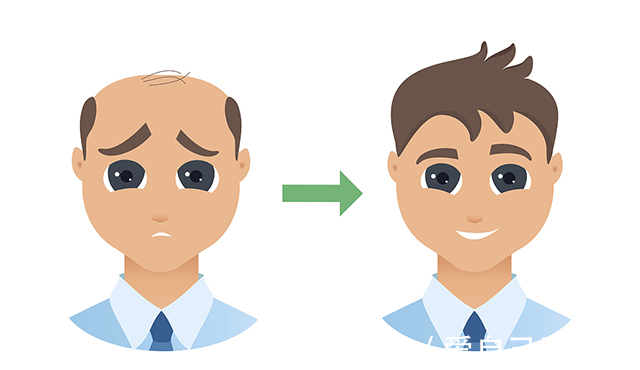 微创 植发到底该重视什么?