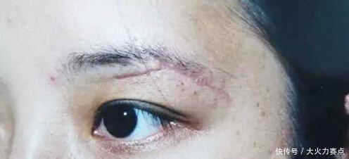 眉毛|为什么不建议女生纹眉内行人说出“底细”,看完再做决定也不晚