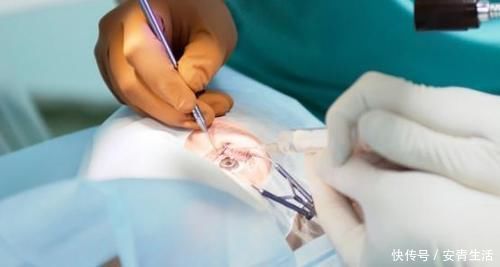 激光类|近视给生活带来不便，这些方法帮您烦恼……