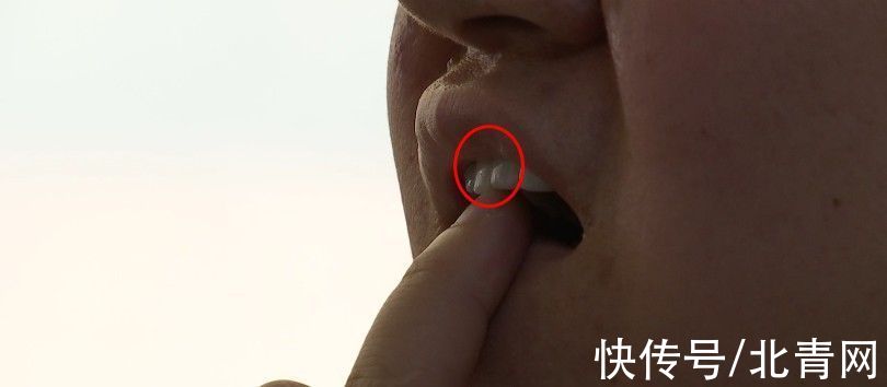 资质|花8000元在美容院做美牙，结果吃东西成问题！院方：是我逼你做的？