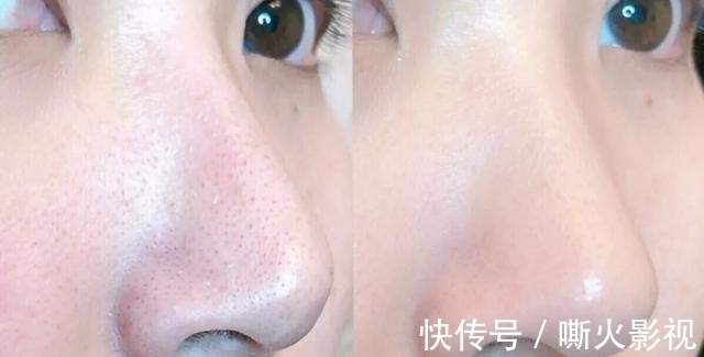 碱性食物 女性过了45岁不要太节俭,多吃5种碱性食物,加一护肤抗衰老