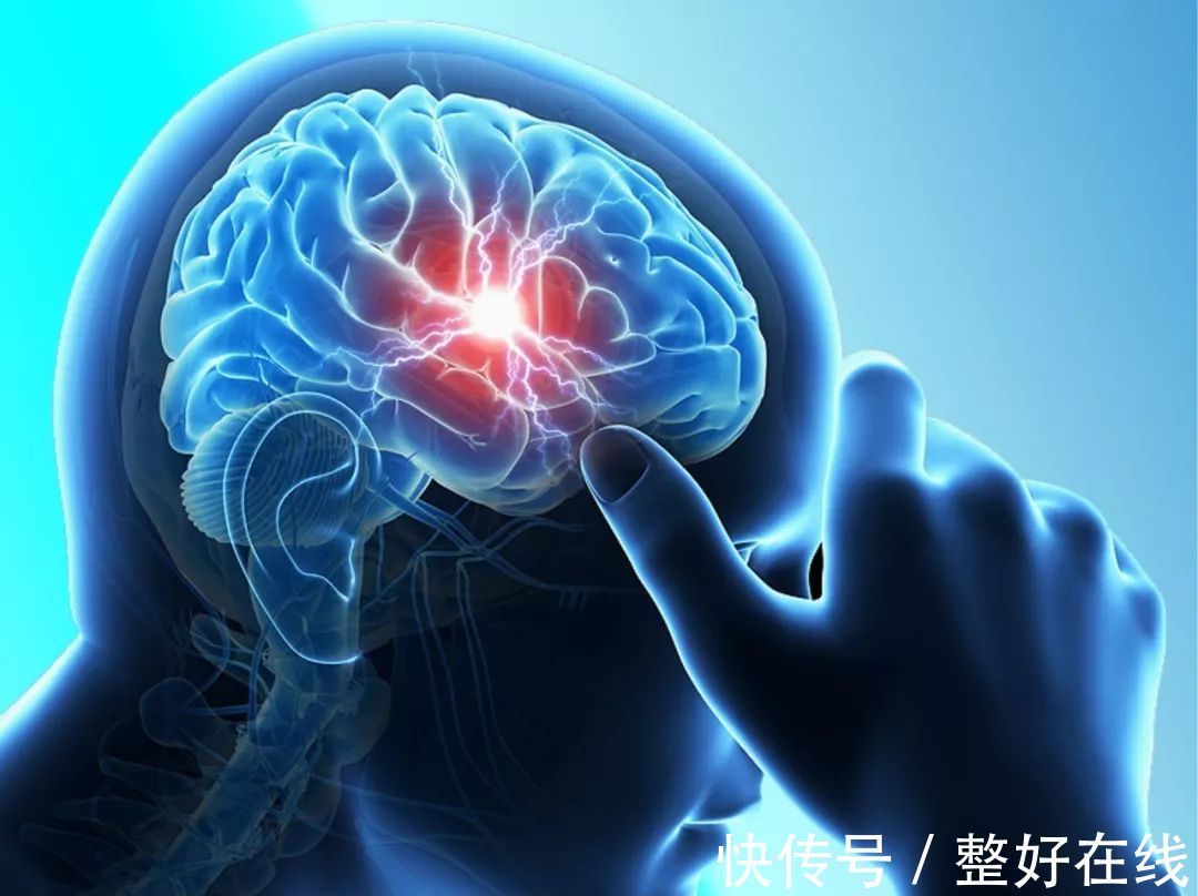 发病率|健康的“头号杀手”脑卒中,俗称中风,引发脑卒中的原因有哪些?