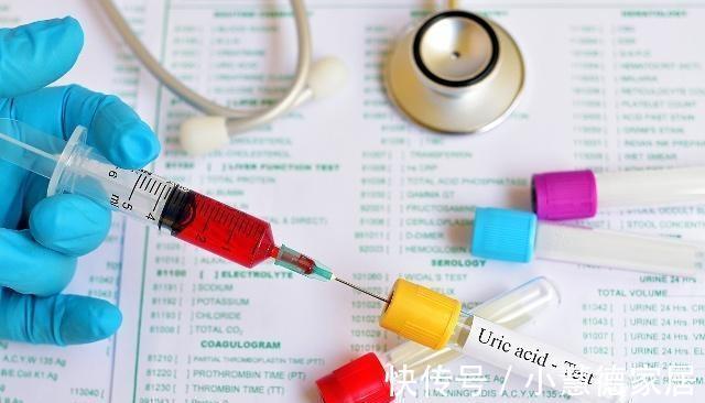 尿酸含量|晚上睡觉若有此些变化，可能是体内尿酸升高了，尽量别大意了