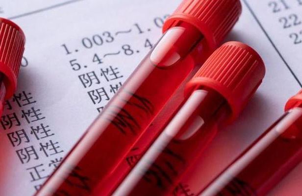 升高血糖|糖尿病人吃红薯,到底会升高血糖,还是降血糖?看完或许更明白