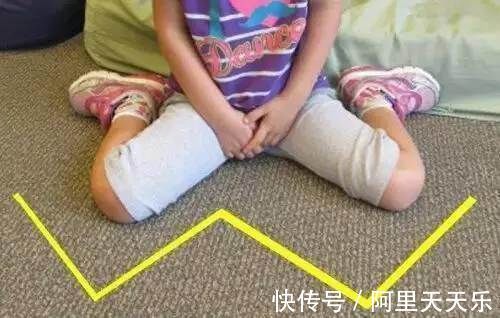 驼背|宝宝的这三种坐姿虽然可爱,却会影响骨骼发育,赶快纠正!