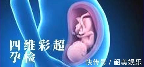 畸形|孕妈深受这三项检查的折磨,忙碌的准爸爸,最好与孕妈一起