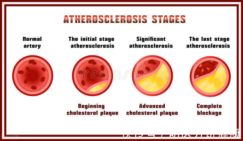 元凶|TA，才是糖尿病的主要元凶！明医方教你有效防范