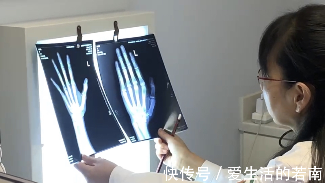 差值|天使讲堂:对于长高来说,骨龄为什么如此重要?