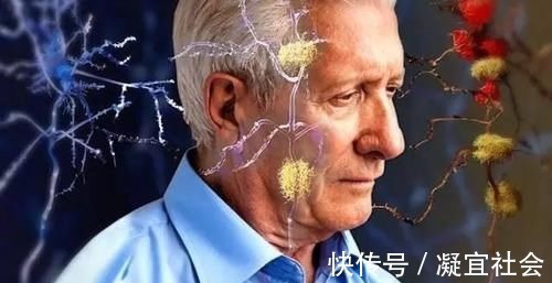 骨质疏松|建议中老年人：不管有钱没钱，尽量多吃4种营养零食，好吃又健康