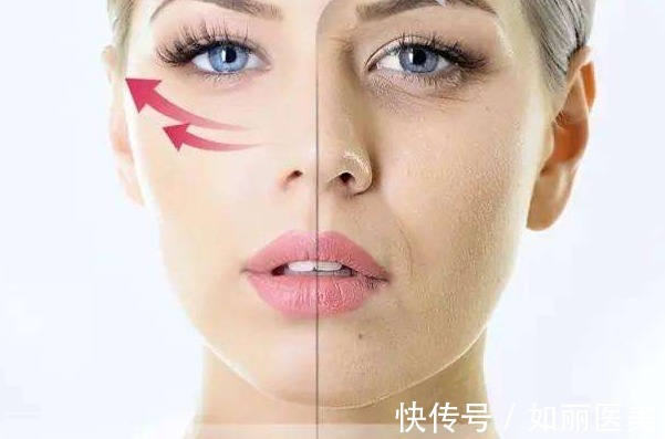 医疗美容 热玛吉一次能维持多久？本文解析热玛吉的维持时间及注意事项！