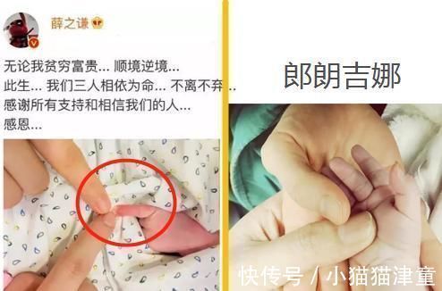 口水疹|郎朗晒娃又被批?这次冤枉!新手准爸妈还有哪些母婴常识需注意?