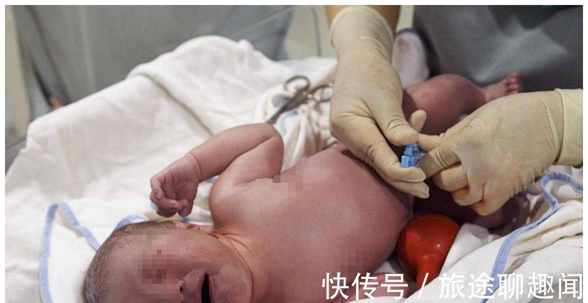 孩子|剪断脐带时,你了解孩子有多疼吗?说出来你都不一定会信