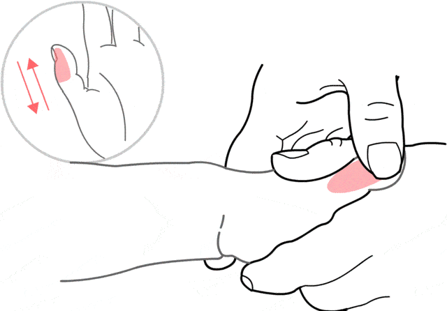 外寒里热的“寒包火”体质会有什么表现？怕风怕冷警惕内热郁积