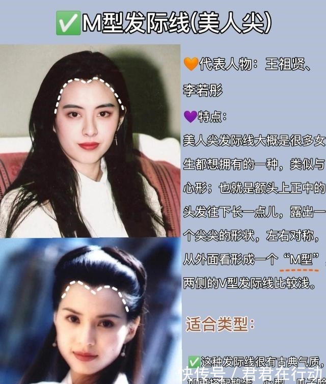 三角形 几种常见的发际线,你又是哪一种呢几分钟教你植发如何选发际线!