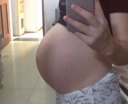 清晰度|现实的四维彩超,不是爬楼梯,就是胎儿不配合