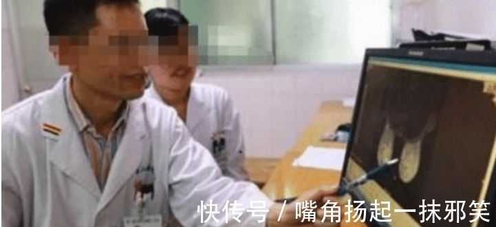 发育|11岁小姑娘胸部发育太厉害, 去医院进行检查才发现原因, 都怪自己的母亲