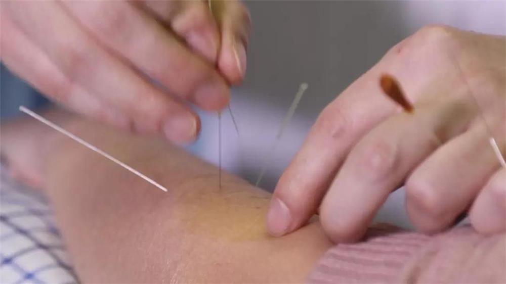 针灸大成|衢州中医流派｜杨继洲针灸