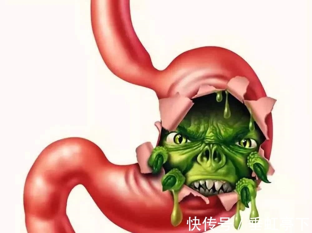 裂纹|胃炎多久变胃癌?舌头有裂纹,必须当心了