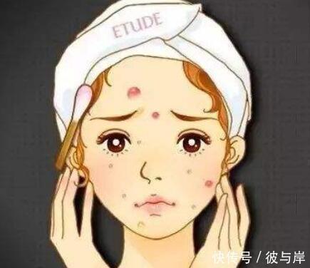 色素|平时的这些行为,会让你长痘之后留痘印,最好能够避开!