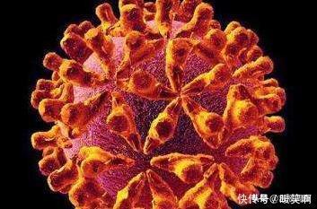 倡导|HIV，如何才能不感染一旦感染该怎么办专家倡导早发现早治疗