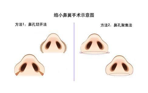 年纪轻轻就失去少女感，还能补救吗？