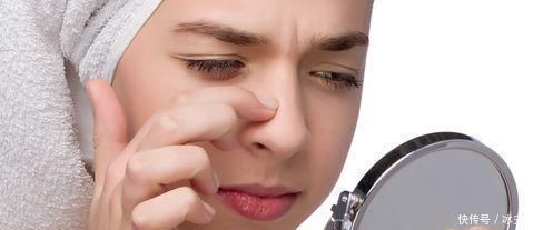 鼻子上黑头去不掉皮肤科医教你1个妙招,轻轻一抹,黑头全出来