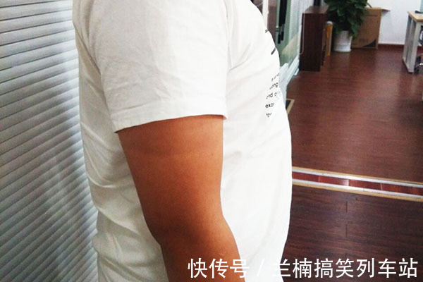 肠癌|身体有癌,肚子先知?腹部的异常表现,值得我们关注