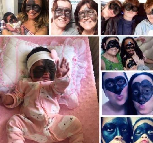 泪目|女子生下“蝙蝠侠”,亲戚朋友不敢靠近,父母的举动却让人泪目