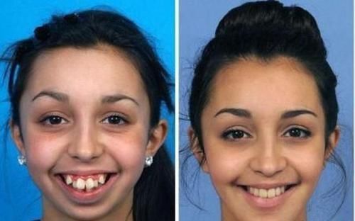 双眼皮|哪些情况才适合整容?做好这3件事还是很丑,那整容也无可厚非