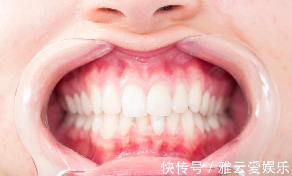 脸色苍白|气血不足怎么判断身体若出现7个信号，说明该补气血了