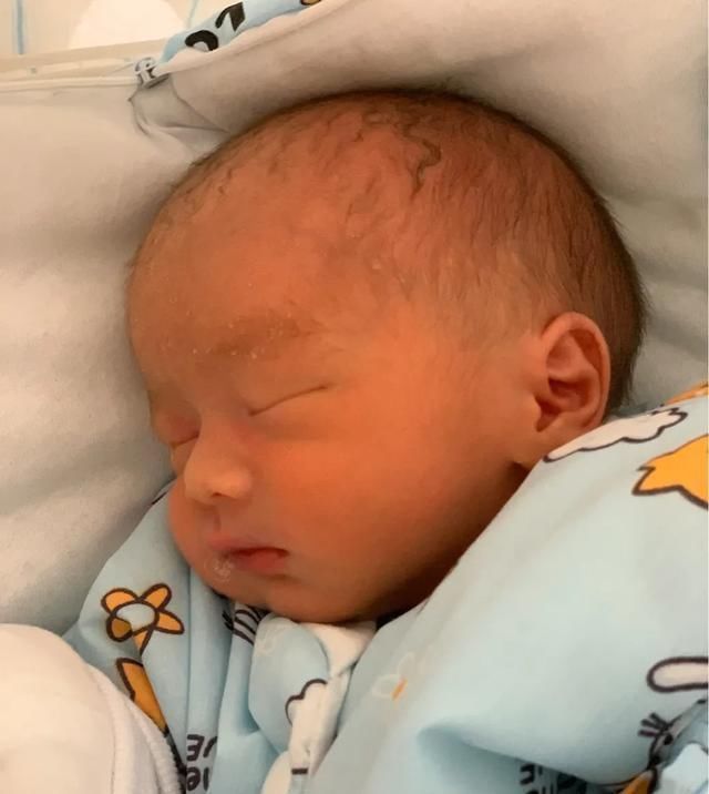 双胞胎|早产双胞胎兄弟,刚出生时瘦如干瘪小老头,11天颜值逆袭变成萌娃