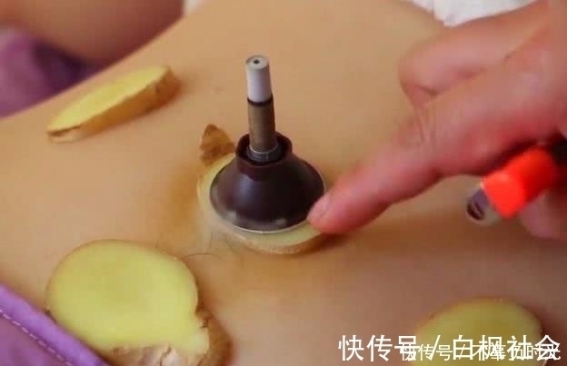 一日三餐|晚上睡前,用生姜敷肚脐,一段时间后,你会收获4个好处!